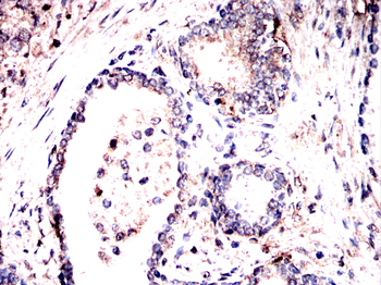 BTRC Antibody