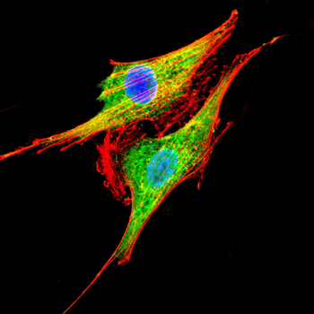 BTRC Antibody