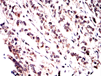 BTRC Antibody