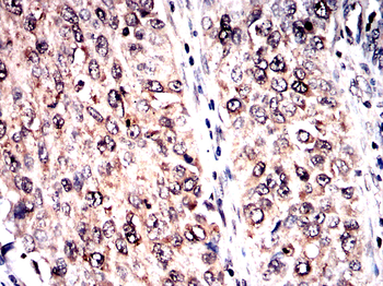 BTRC Antibody