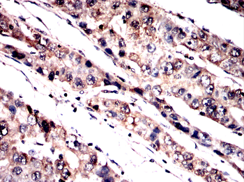 BTRC Antibody