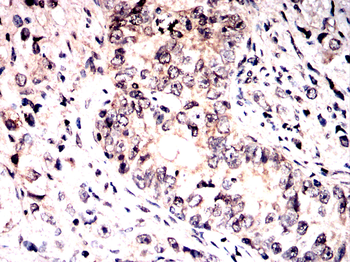 BTRC Antibody