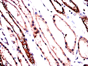 PKM Antibody