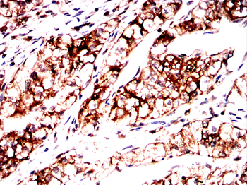 PKM Antibody
