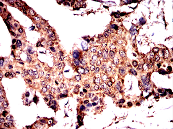 PKM Antibody