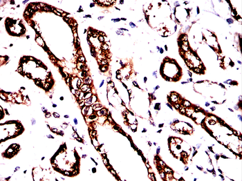 PKM Antibody
