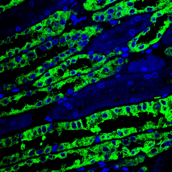 PKM Antibody