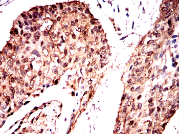 PKM Antibody
