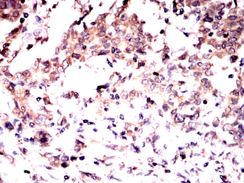 PKM Antibody