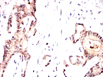 SYNE1 Antibody
