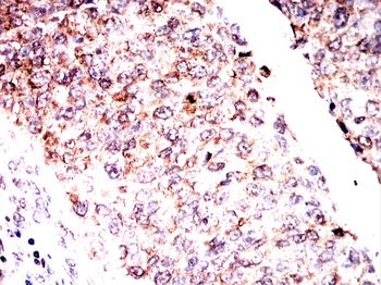 FDX1 Antibody