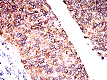 FDX1 Antibody