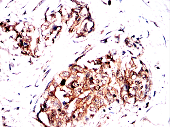 NOG Antibody