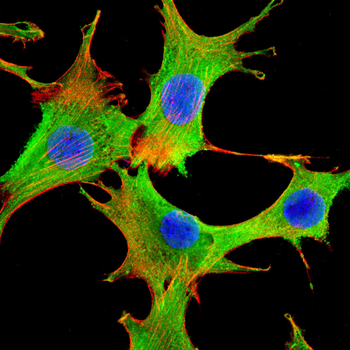 SLC17A7 Antibody