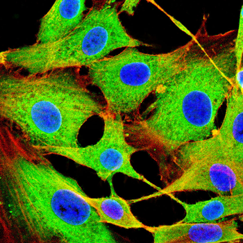 SLC17A7 Antibody