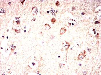 SLC17A7 Antibody