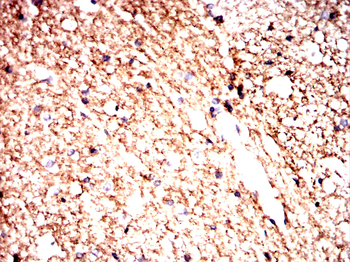 SLC17A7 Antibody