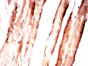SLC17A7 Antibody