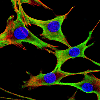 ACTN2 Antibody