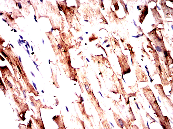 ACTN2 Antibody