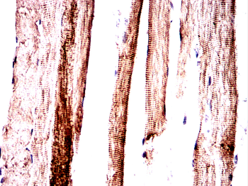ACTN2 Antibody