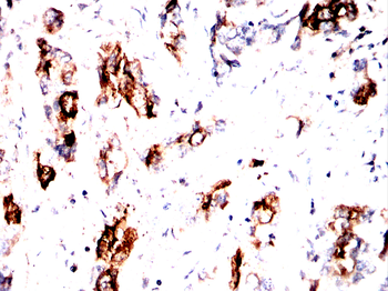 ACTN2 Antibody