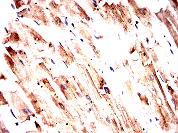 ACTN2 Antibody