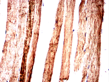 ACTN2 Antibody
