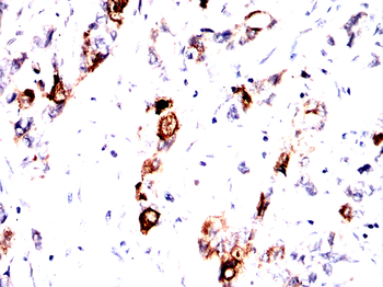 ACTN2 Antibody