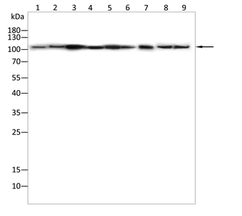 ACTN2 Antibody