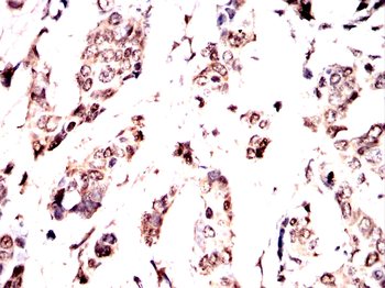 RPSA Antibody