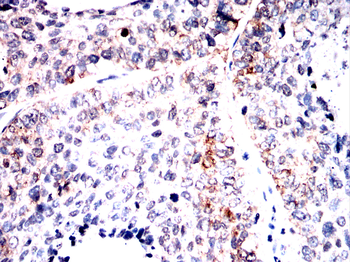 RPSA Antibody