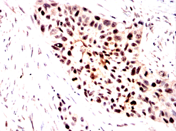 RPSA Antibody