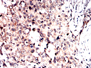 RPSA Antibody