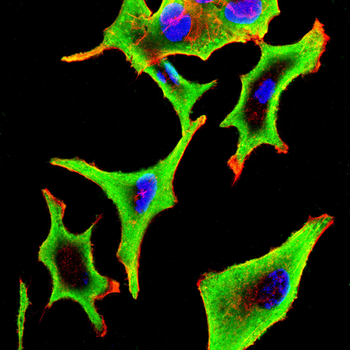 IGF1R Antibody