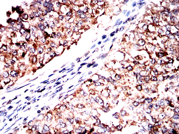 NCL Antibody