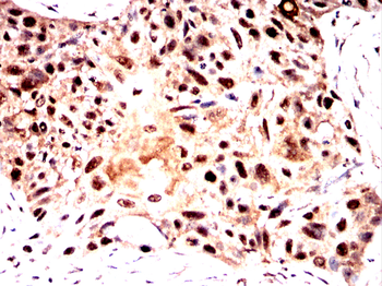NCL Antibody