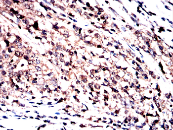 NCL Antibody