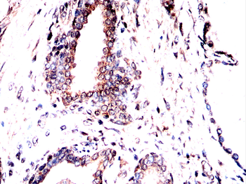 NCL Antibody