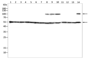 NCL Antibody