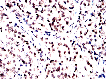NCL Antibody