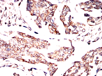 NCL Antibody