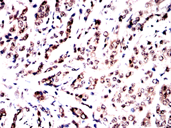 NCL Antibody