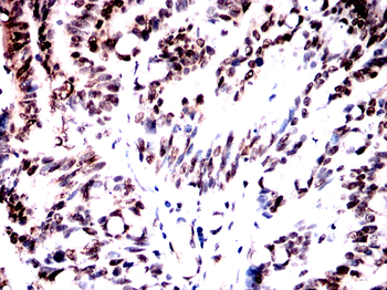 NCL Antibody