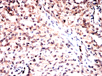 NCL Antibody