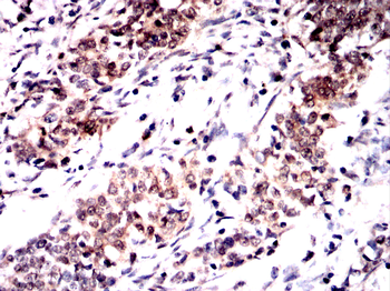 FOXC1 Antibody