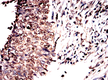 FOXC1 Antibody