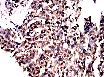 FOXC1 Antibody