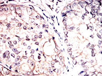 FOXC1 Antibody