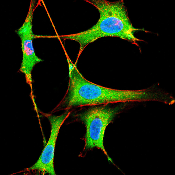 KRT1 Antibody